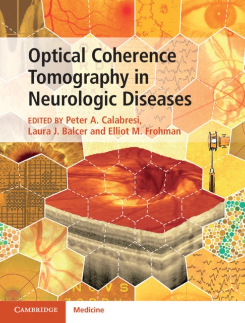 Book cover of: Optical Coherence Tomography in Neurologic Diseases. By: Peter A. Calabresi