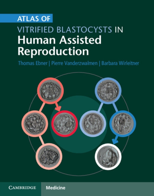 Book cover of: Atlas of Vitrified Blastocysts in Human Assisted Reproduction. By: Thomas Ebner