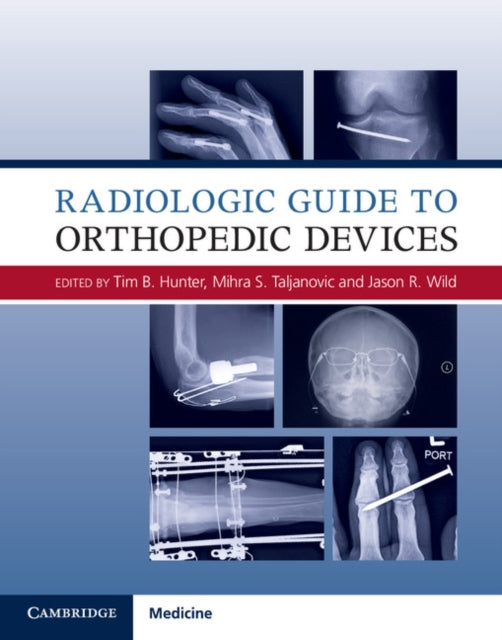 Book cover of: Radiologic Guide to Orthopedic Devices. By: Tim B. Hunter