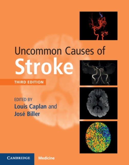 Book cover of: Uncommon Causes of Stroke