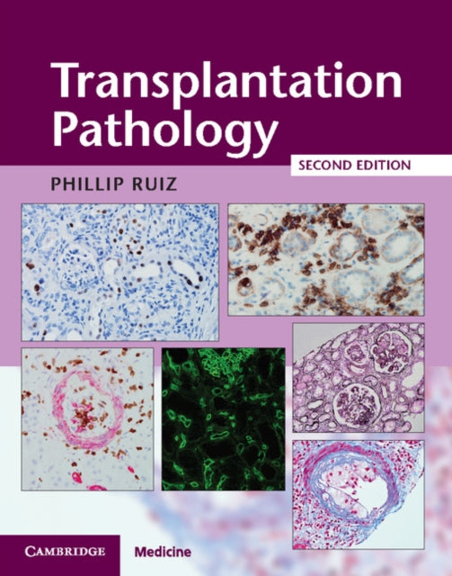Book cover of: Transplantation Pathology Hardback with Online Resource. By: Phillip Ruiz