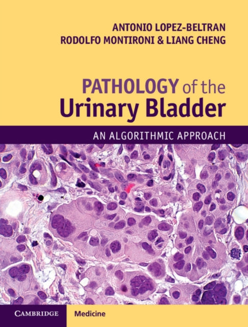 Book cover of: Pathology of the Urinary Bladder. By: Antonio Lopez-Beltran