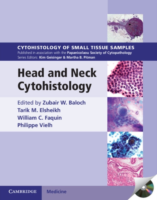 Book cover of: Head and Neck Cytohistology with DVD-ROM. By: Zubair W. Baloch