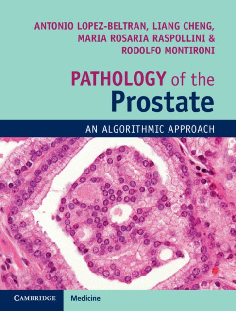 Book cover of: Pathology of the Prostate. By: Antonio Lopez-Beltran