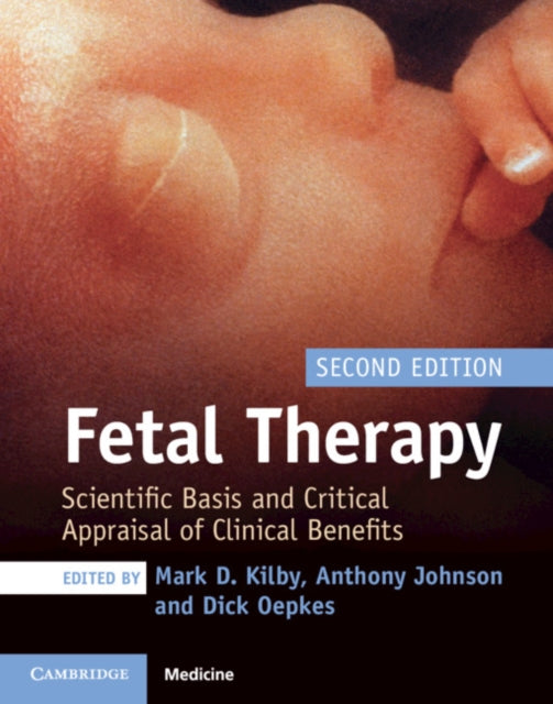 Book cover of: Fetal Therapy. By: Mark D. Kilby