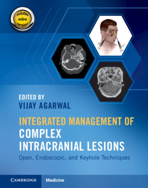 Book cover of: Integrated Management of Complex Intracranial Lesions Hardback Set and Static Online Product. By: Vijay Agarwal
