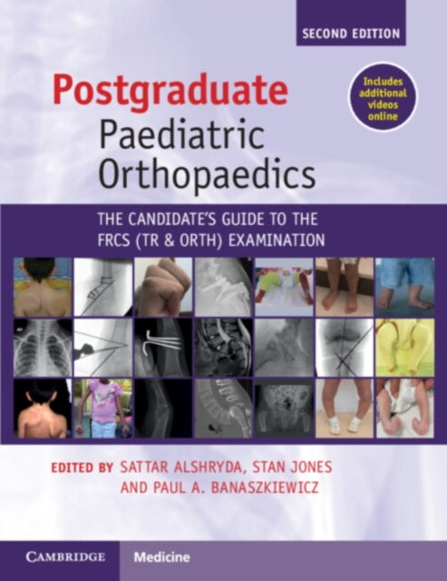Book cover of: Postgraduate Paediatric Orthopaedics. By: Sattar Alshryda