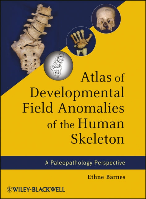 Book cover of: Atlas of Developmental Field Anomalies of the Human Skeleton. By: Ethne Barnes