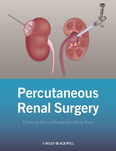 Book cover of: Percutaneous Renal Surgery. By: Manoj Monga