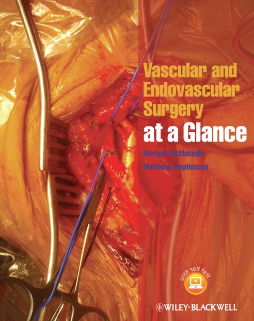 Book cover of: Vascular and Endovascular Surgery at a Glance
