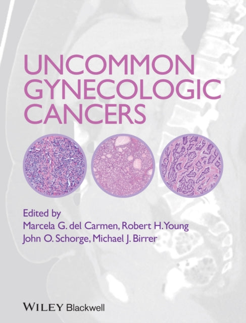 Book cover of: Uncommon Gynecologic Cancers. By: Marcela Del Carmen