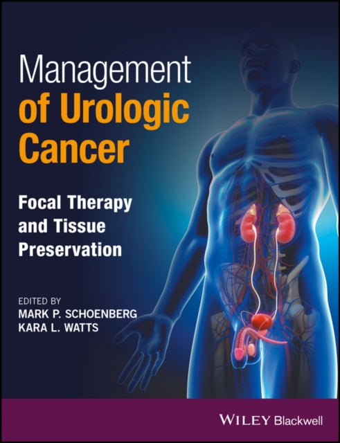Book cover of: Management of Urologic Cancer