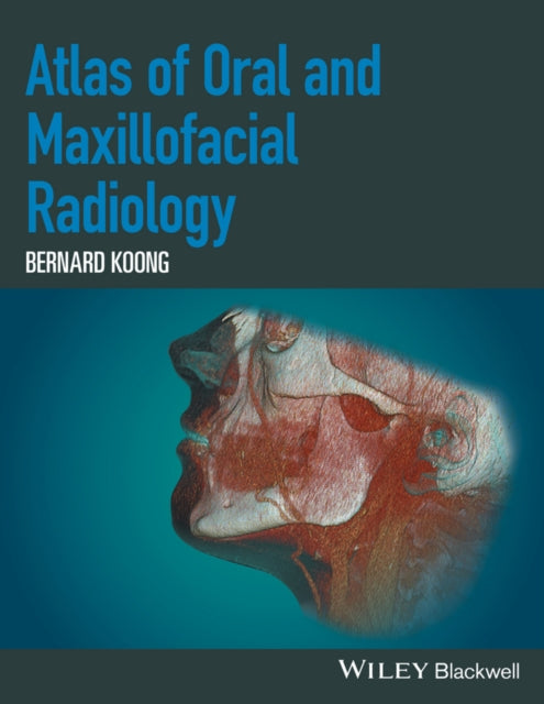 Book cover of: Atlas of Oral and Maxillofacial Radiology. By: Bernard Koong