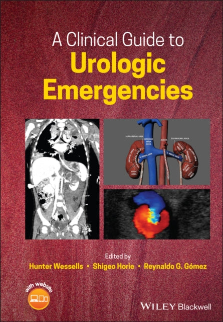 Book cover of: Clinical Guide to Urologic Emergencies. By: Shigeo Horie