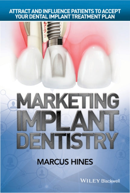 Book cover of: Marketing Implant Dentistry. By: Marcus Hines