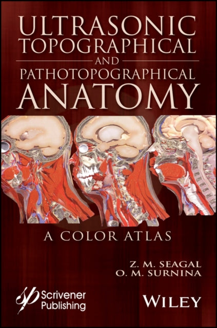 Book cover of: Ultrasonic Topographical and Pathotopographical Anatomy. By: Z. M. Seagal