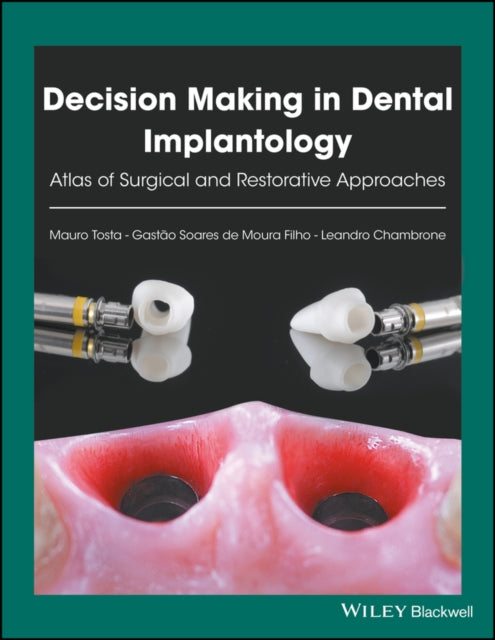 Book cover of: Decision Making in Dental Implantology. By: Mauro Tosta