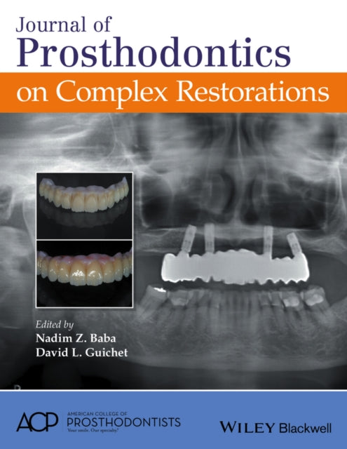 Book cover of: Journal of Prosthodontics on Complex Restorations. By: Nadim Z. Baba