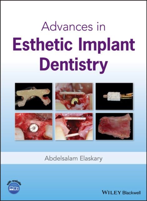 Book cover of: Advances in Esthetic Implant Dentistry. By: Abdelsalam Elaskary