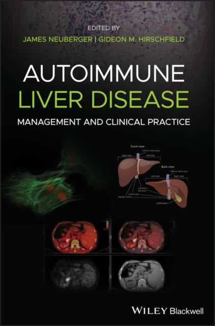 Book cover of: Autoimmune Liver Disease. By: James Neuberger