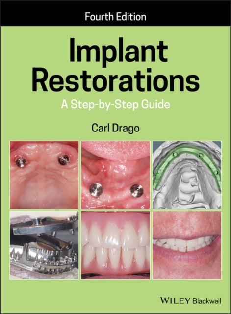 Book cover of: Implant Restorations. By: Carl Drago