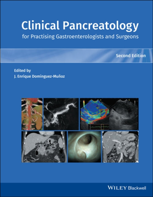 Book cover of: Clinical Pancreatology for Practising Gastroenterologists and Surgeons. By: Juan Enrique Dominguez-Munoz