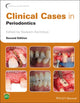Book cover of: Clinical Cases in Periodontics. By: Nadeem Karimbux