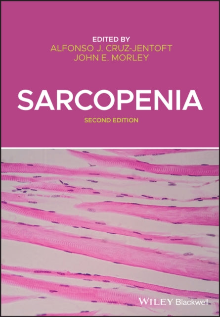 Book cover of: Sarcopenia. By: Alfonso A. Cruz-Jentoft
