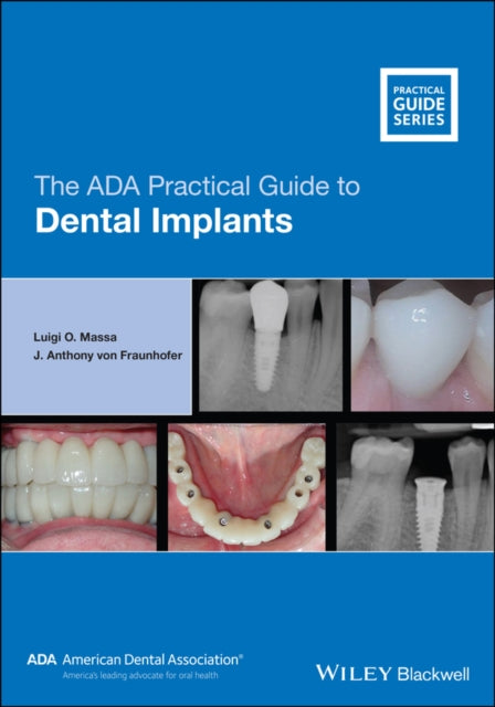 Book cover of: ADA Practical Guide to Dental Implants. By: Luigi O. Massa