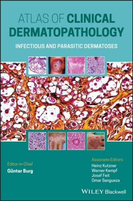 Book cover of: Atlas of Clinical Dermatopathology. By: Günter Burg
