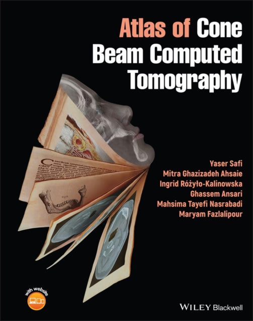 Book cover of: Atlas of Cone Beam Computed Tomography. By: Yaser Safi