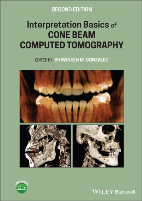Book cover of: Interpretation Basics of Cone Beam Computed Tomography. By: Shawneen M. Gonzalez