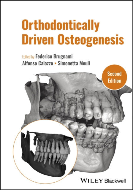 Book cover of: Orthodontically Driven Osteogenesis. By: Federico Brugnami