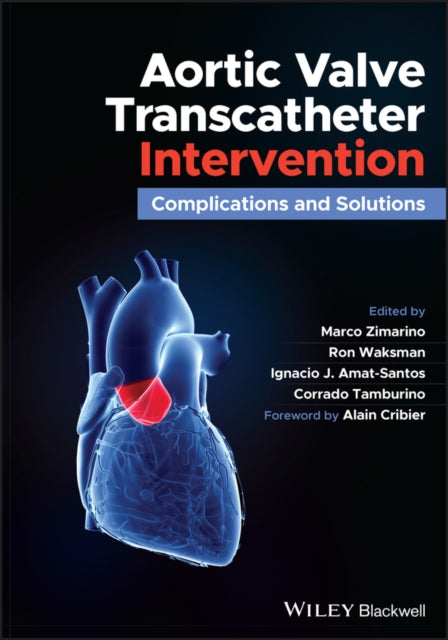 Book cover of: Aortic Valve Transcatheter Intervention. By: Marco Zimarino