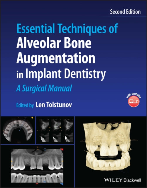 Book cover of: Essential Techniques of Alveolar Bone Augmentation in Implant Dentistry. By: Len Tolstunov