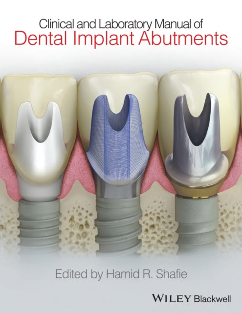 Book cover of: Clinical and Laboratory Manual of Dental Implant Abutments. By: Hamid R. Shafie