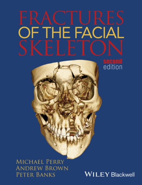 Book cover of: Fractures of the Facial Skeleton. By: Perry, Michael (Surgeon)