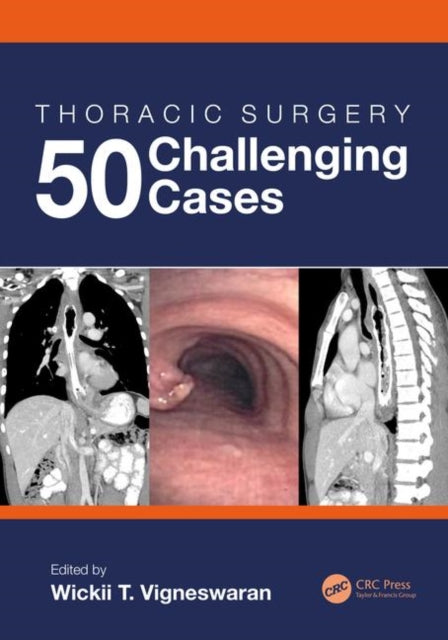 Book cover of: Thoracic Surgery: 50 Challenging cases. By: Wickii Vigneswaran