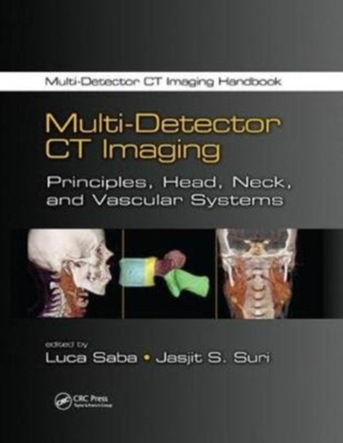 Book cover of: Multi-Detector CT Imaging. By: Luca Saba
