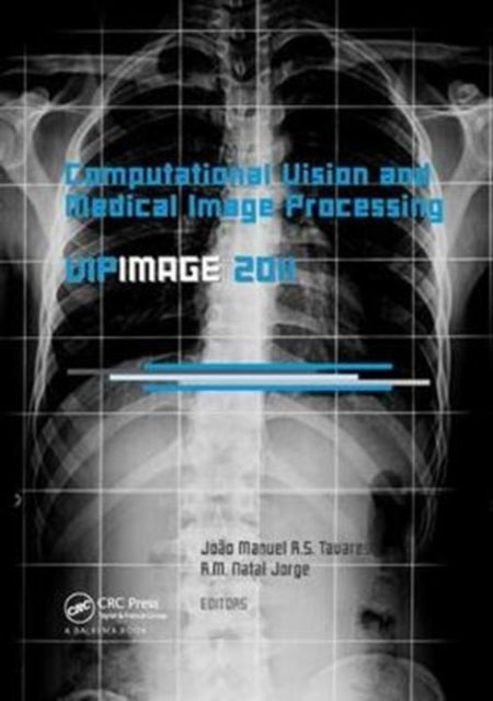 Book cover of: Computational Vision and Medical Image Processing: VipIMAGE 2011. By: João Manuel R. S. Tavares