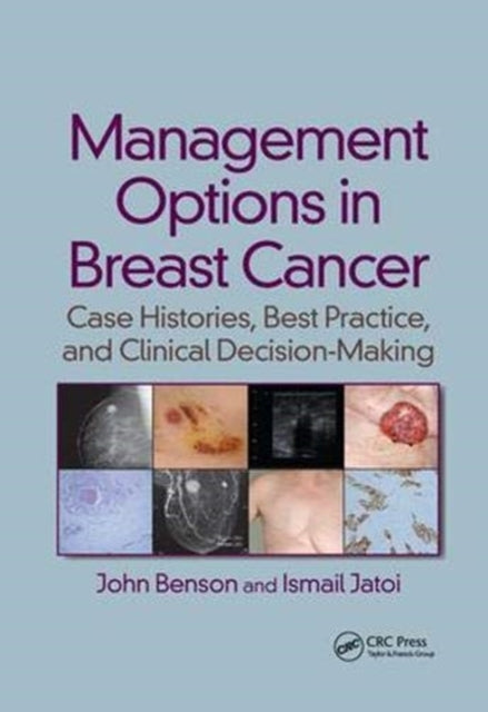 Book cover of: Management Options in Breast Cancer. By: John Benson