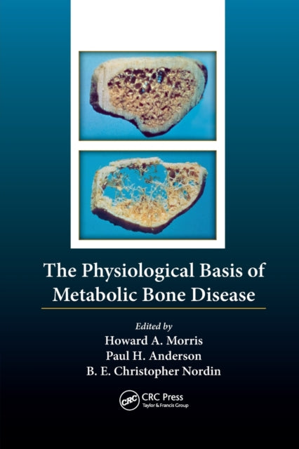 Book cover of: Physiological Basis of Metabolic Bone Disease. By: B. E. Christopher Nordin