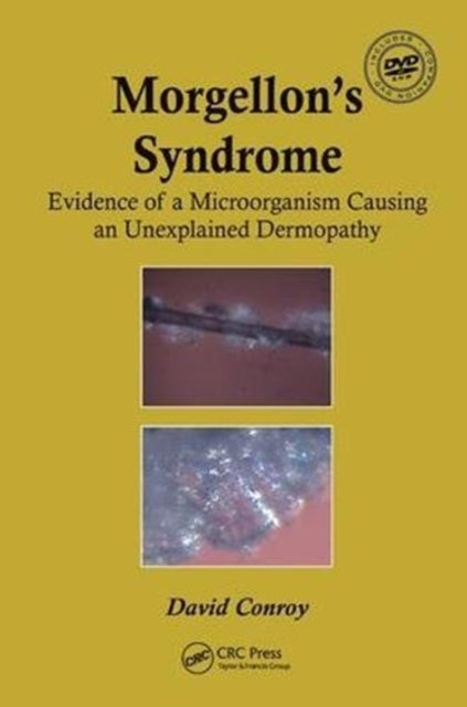 Book cover of: Morgellon's Syndrome. By: David Conroy