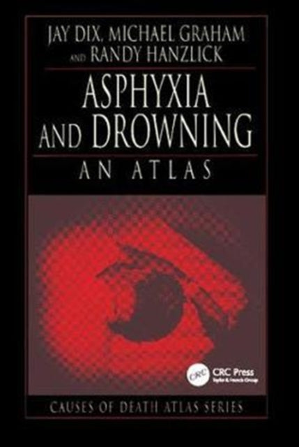 Book cover of: Asphyxia and Drowning. By: Jay Dix
