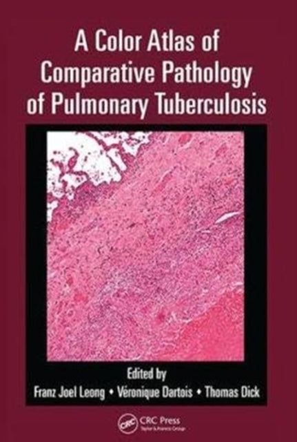 Book cover of: Color Atlas of Comparative Pathology of Pulmonary Tuberculosis. By: Franz Joel Leong