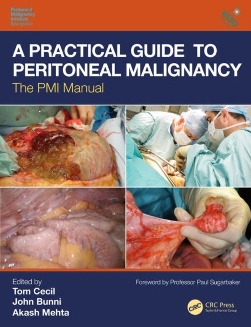 Book cover of: Practical Guide to Peritoneal Malignancy. By: Tom Cecil
