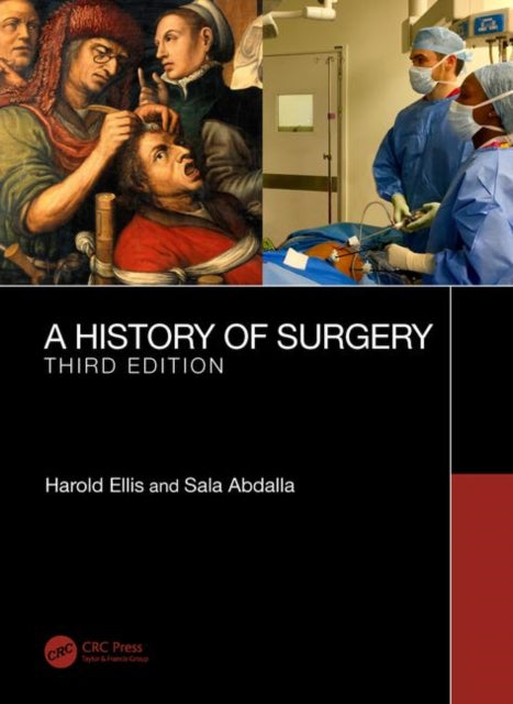 Book cover of: History of Surgery. By: Harold Ellis