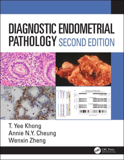 Book cover of: Diagnostic Endometrial Pathology 2E. By: T. Yee Khong