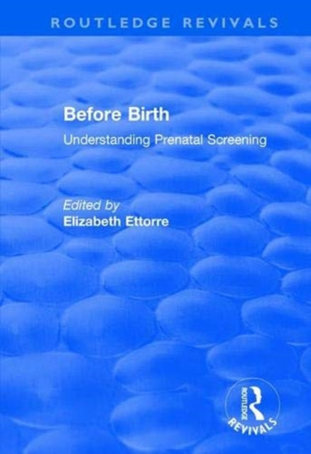 Book cover of: Before Birth. By: Elizabeth Ettorre