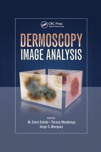 Book cover of: Dermoscopy Image Analysis. By: M. Emre Celebi